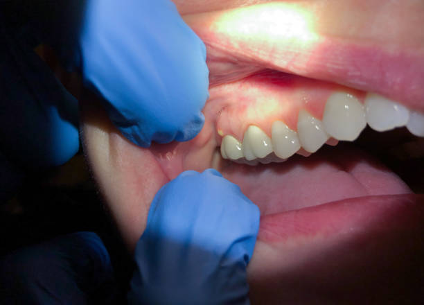 Best Emergency Denture Repair in Fort Sumner, NM